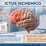L’ictus cos’è, quali sono i sintomi ed in che modo possiamo riconoscerlo quando arriva